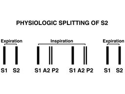 Heart sounds physiologic splitting of S2