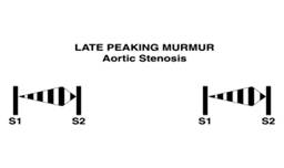 Late peaking murmur