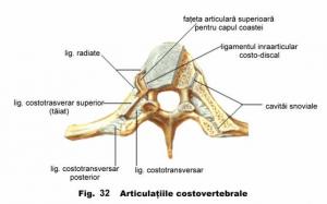 artroza costovertebrală a regiunii toracice