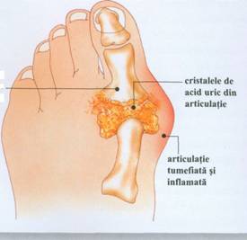 Anatomia piciorului | Clinica Picioarelor