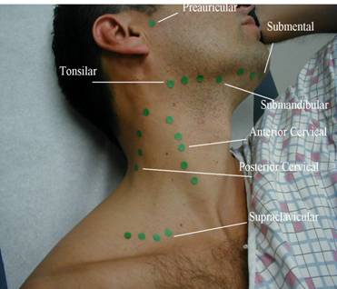 Lymph nodes of the head and neck