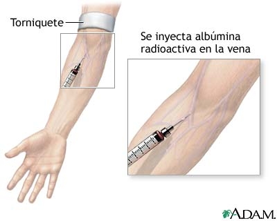 Albumina (origine hepatica, 55 - 65 % proteine totale, t  15-18 zile)