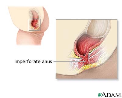 anus