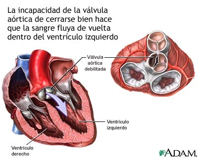 Valvula aortica