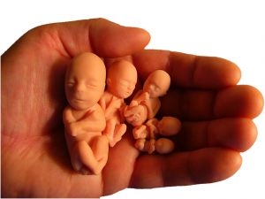 imagine cu avortul