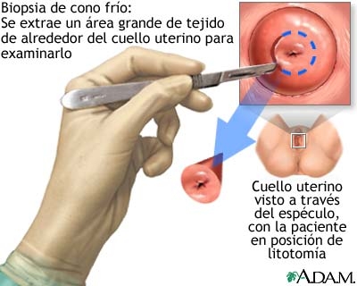 imagini biopsia