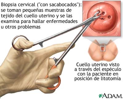 Laringologia (examenul laringelui) - laringoscopia, stroboscopia, biopsia