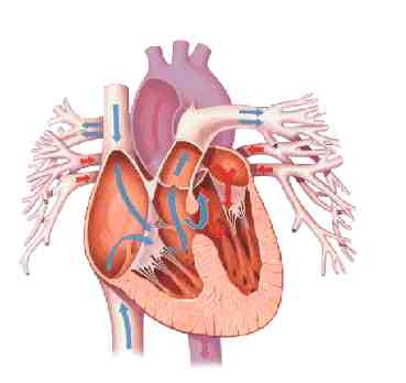 Alte cardiopatii cianogene cu debit pulmonar diminuat