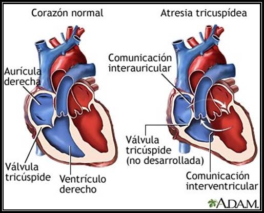 imagini cardiopatii