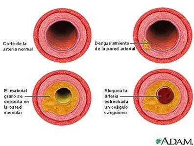 Diagnosticul tulburarilor de ritm asociate unei cardiopatii