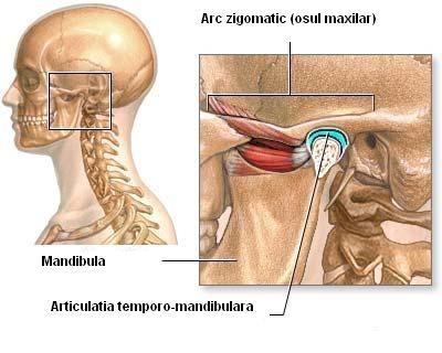 Cefaleea si durerea faciala - migrena