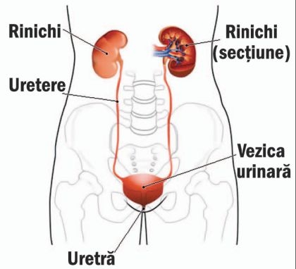 Cistita - acuta si cistita alergica - tratarea cistitei