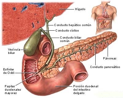 imagini colelitiaza