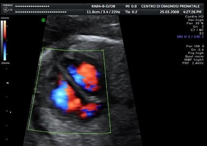 Electrocardiografia si ecocardiografia