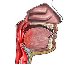 Angina (faringita) acuta