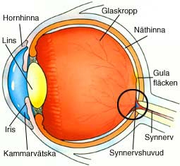 Glaucomul congenital