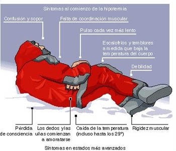 Hipotermia si degeraturile