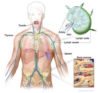 Anatomia patologica a limfomului hodgkin. diagnosticul microscopic