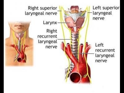 imagini laringita