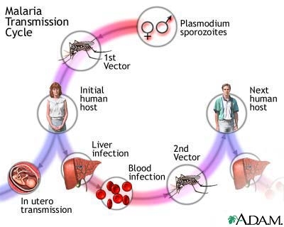 Malaria (paludismul)