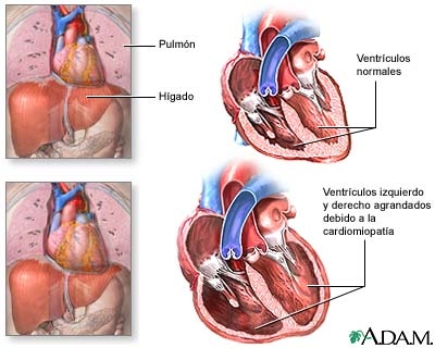 imagini miocardopotiile