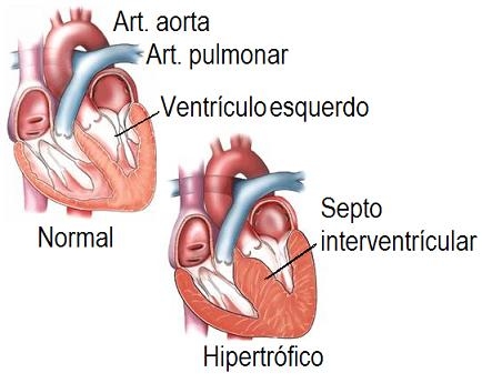 poza despre miocardopotiile