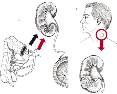 Infectiile de Tract Urinar - [PDF Document]