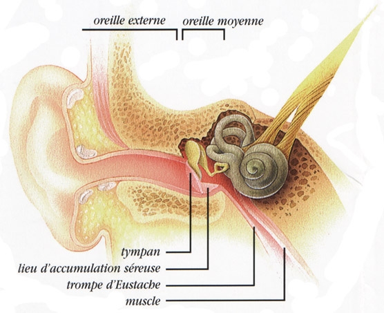 Otitele