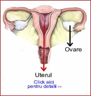 Probleme la ovar - ovariene