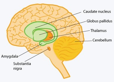 Parkinsonul