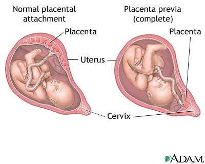 Elemente de morfologie si fiziologie a placentei: ovoimplantatia, organizarea, placenta matura