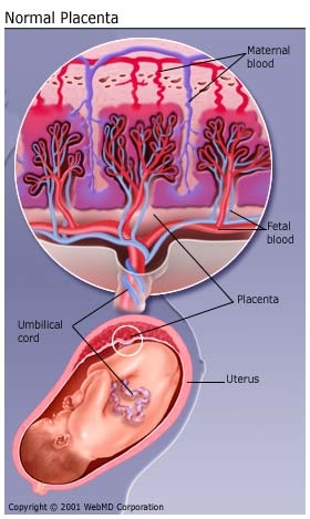 Retentia de placenta