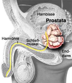 imagini prostata