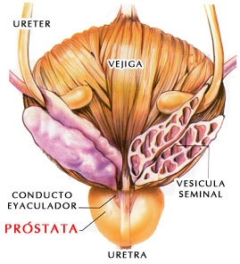 Prostata (hipertrofie si congestie)