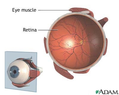 Fleck retina of kandori syndrome (kandori syndrome) 4