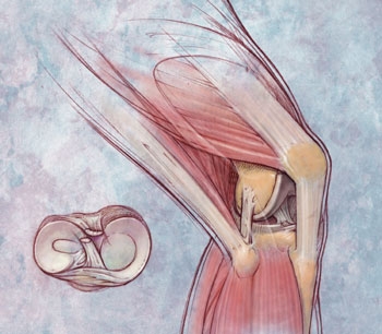 Reumatism cronic