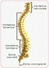 Scolioza