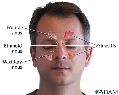 poza despre sinus