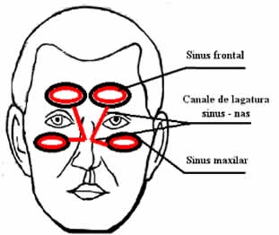 Sinuzitele supurate acute