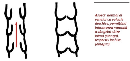 Cum diagnosticam o tromboza a axului venos