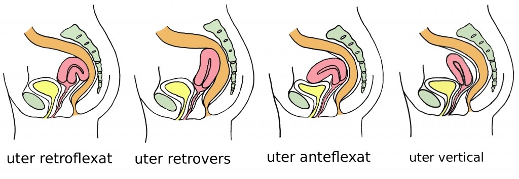 imagini uterul