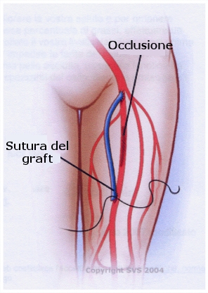 imagini vasculopatiile